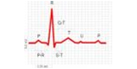 159 ekg 15060